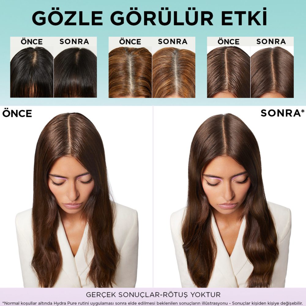 L'Oréal Paris Elseve Hydra [Hyaluronic] Pure Salisilik Asit İçeren Yağlanma Karşıtı Arındırıcı Şampuan 300 Ml