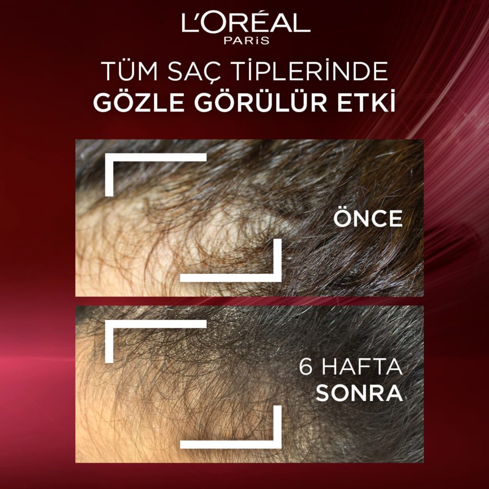 Elseve Komple Direnç Dökülme Karşıtı Bakım Şampuanı 300 Ml