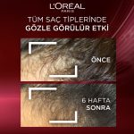 Elseve Komple Direnç Dökülme Karşıtı Bakım Şampuanı 300 Ml